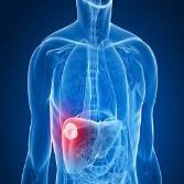 Ablation توده‌های کبدی