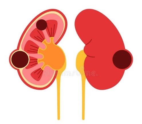 تخلیه اسکلروتراپی کیست‌های کلیه