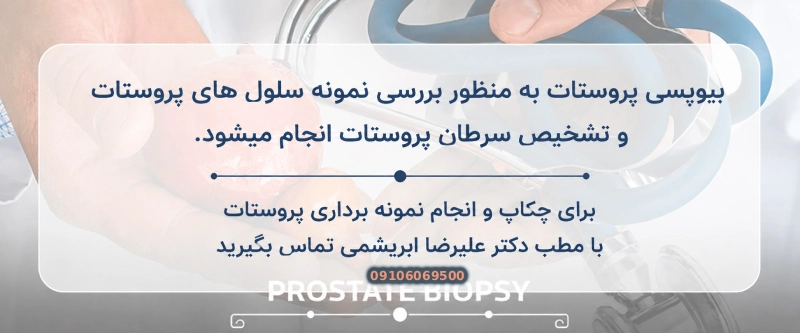 آمادگی قبل از بیوپسی پروستات
