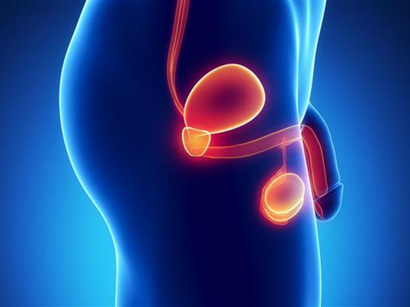 پروستات چیست؛ علائم، عوارض و علت بزرگی آن