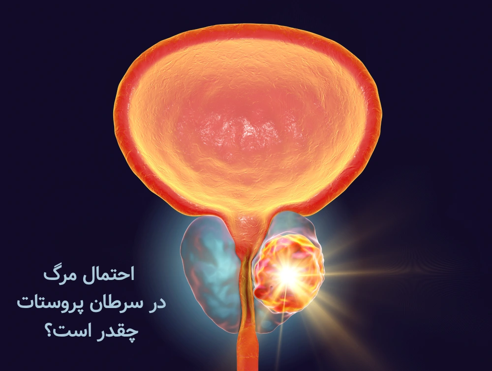احتمال مرگ در سرطان پروستات
