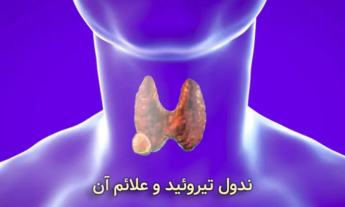 ندول تیروئید