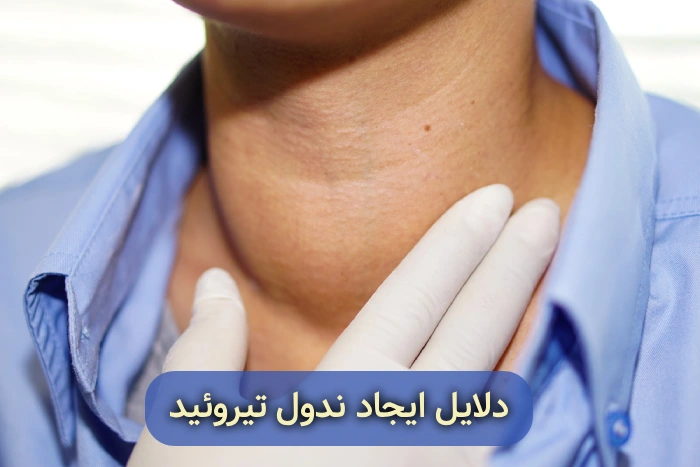علت بروز ندول تیروئید